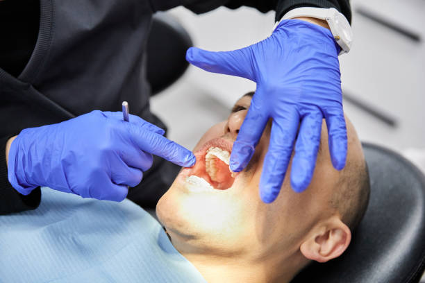 Best Emergency Wisdom Tooth Extraction in Williston, SC