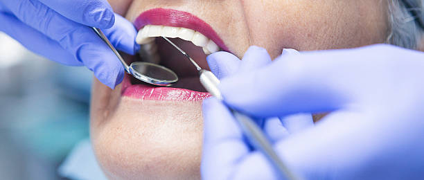 Best Broken or Chipped Tooth Repair in Williston, SC